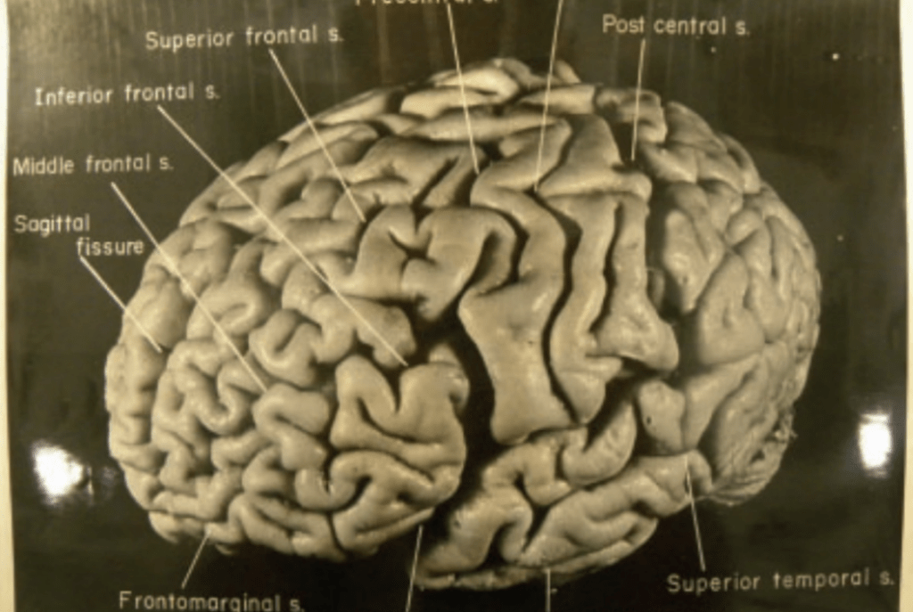 Une des photographies du cerveau d'Albert Einstein prises par Thomas Harvey en 1955 - Cultea
