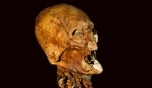 Crâne momifié Henri IV