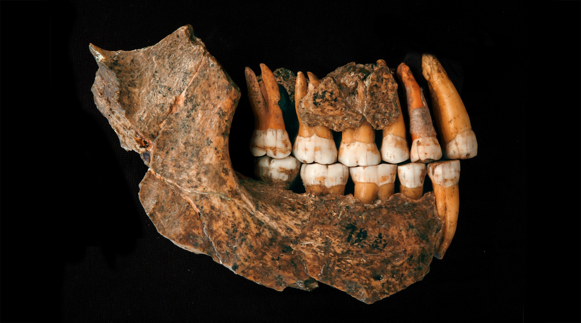 Découverte d'« aspirine » dans une dent d'Homme de Néandertal