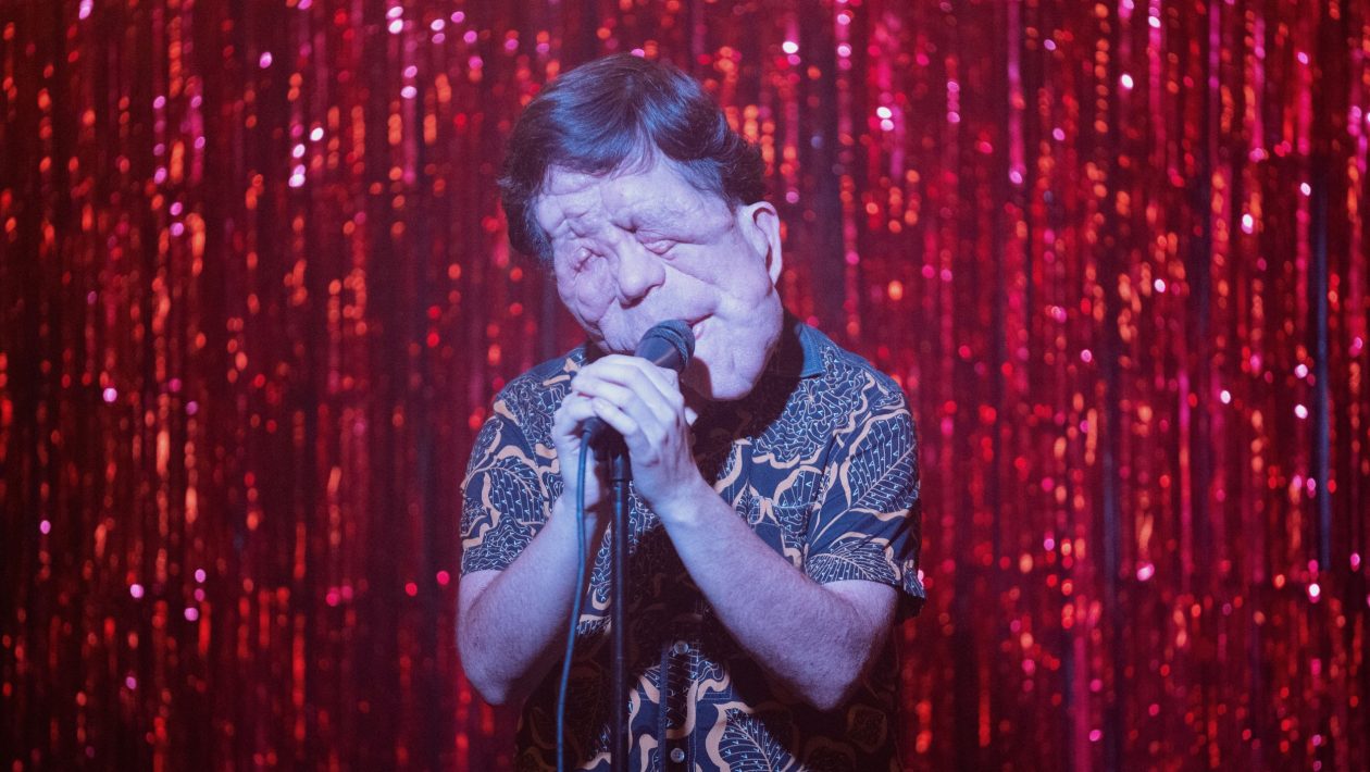 « Elephant Man » : Adam Pearson portera la nouvelle version