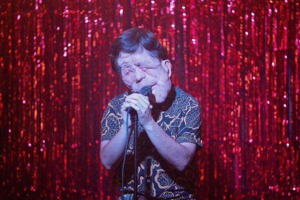 « Elephant Man » : Adam Pearson portera la nouvelle version