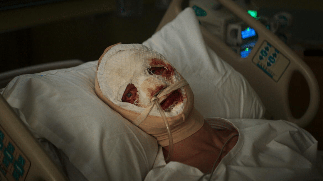 clayface-hospital